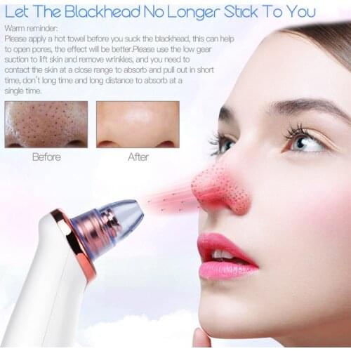 Removal Vacuum Suction Facial Diamond Beauty Clean Skin Tool Blackhead Remover Face Deep Nose Cleaner T Zone Pore Acne Pimple