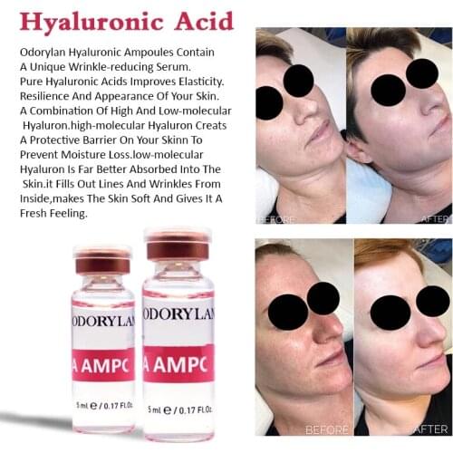 Mesotherapy Serum Hyaluronic Acid Ampoule BB Cream Glow HA Collagen Skin Whiten Serum Cross-linked for Microneedle Treatment