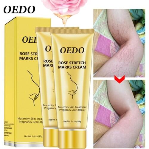 Rose Removes Stretch Mark Cream To Remove Postpartum Obesity Pregnant Women Repair Anti-Aging Anti-Winkles Firming Body Cream