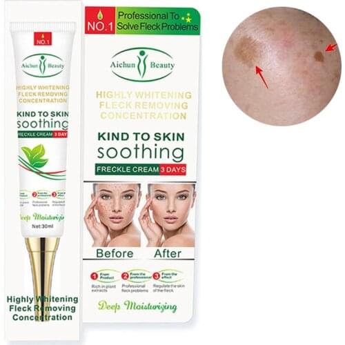 Freckle Cream Whitening Remove Chloasma Acne Spots Melanin Brighten Moisturizing Lifting Firm Repair Nourishing Skin Care 30ml