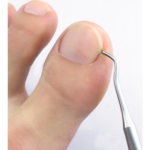 Ingrown Toe Nail Correction Lifter Nail File Clean Installation Tool Pedicure Foot Nail Care Hook Cleaner Double Sided
