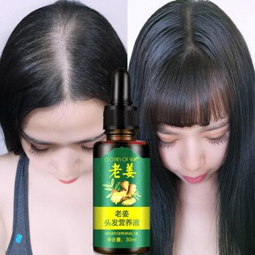 Ginger hair Nutrition solution prevent hair loss and hair increase essential Oil of Ginger hair Camp liquid