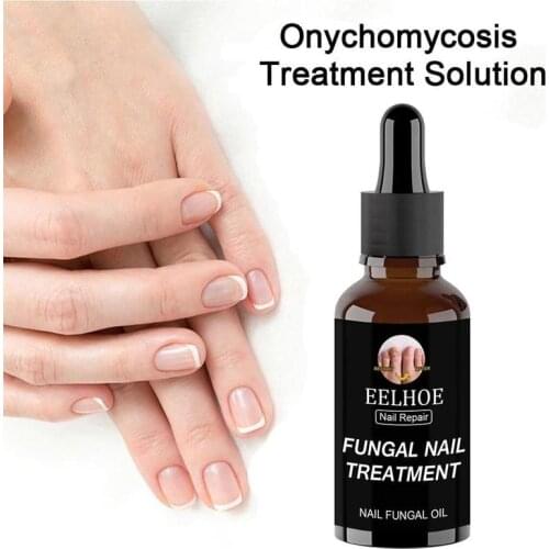 Fast Fungal Nail Treatments Serum Anti-Fungal Nail Sensitive Herb Toe Fungus Onychomycosis Paronychia Foot Repair Essences Care