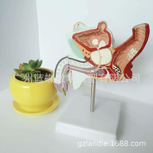 1:1 Life Size Human Medical Anatomy Male Internal Reproductive Pathology Lesion Anatomical Urinary System Disease Model