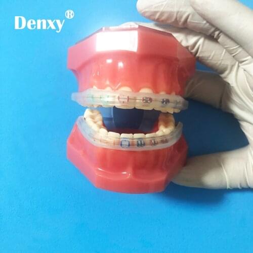 1 Pack Orthodontic Braces Mouth Protector Guard Comfort Lip Bumpers Orthodontic Bracket Protective Sleeve