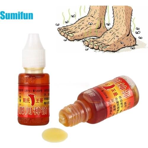 10ml Foot Beriberi Oil Athletes Foot Plaster Erosive Beriberi Remove Sweat Odor Psoriasis Peeling Antibacterial Ointment Care