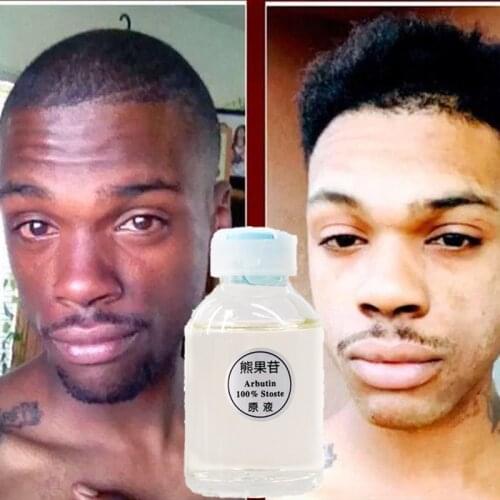 30ml Skin Whitening Lightening Brightening Serum Kojic Acid Serum Bleaching Dark Spot Cream