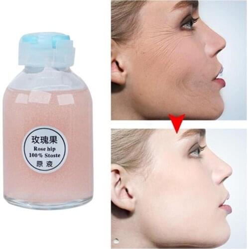 30ml Rosehip Original Liquid Face Essence Whitening Brightening Skin Cleansing Serum Anti-aging Anti Essence Care