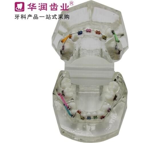 Patient communication model Dentistry teeth Orthodontic model free shipping