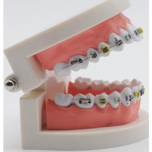 Dentist Study Orthodontic Model Ortho Metal Bracket Arch Wire Ligature Tie For Dental Supplies