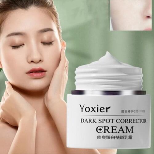 Face Cream Dark Spot Corrector Anti-Aging Whitening Moisturizing Remove Sunburn Dark Spots And Acne Pigmentation 30g