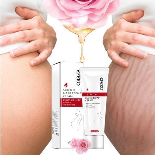 EFERO Pregnancy Scar Remove Acne Cream Stretch Marks Treatment Maternity Repair Cream Anti-Aging Anti Winkles Firming Body Cream