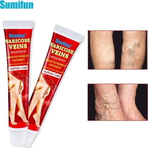 1/2Ppcs 20G Sumifun Varicose Veins Treatment Cream Original Vasculitis Phlebitis Spider Pain Relief Ointment Medical Plaster