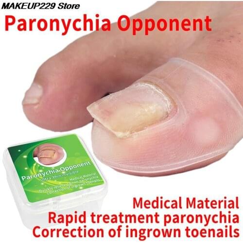 2pc Silicone Ingrown Toenail Correction Tool Invisible Ingrown Toe Nail Treatment Elastic Straightening Clip Brace Pedicure Tool