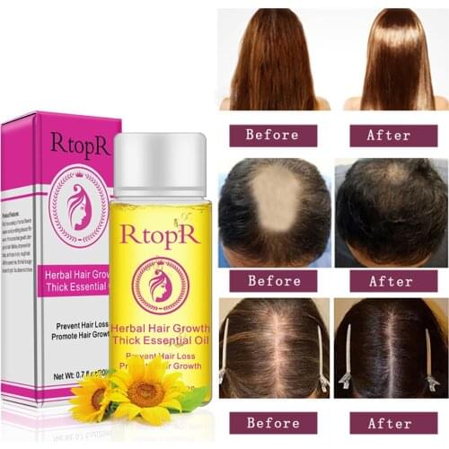 Hair Growth Essential Oil Hair Loss Liquid Promote Thick Fast Anti Hair Growth Treatment Health Care Massage Essence Oil