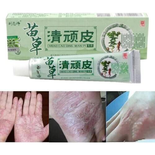 1pc Herbal Psoriasis Ointment Dermatitis Eczema Treatment Skin Cream Antibacterial Anti inflammatory Pain Relief Cream