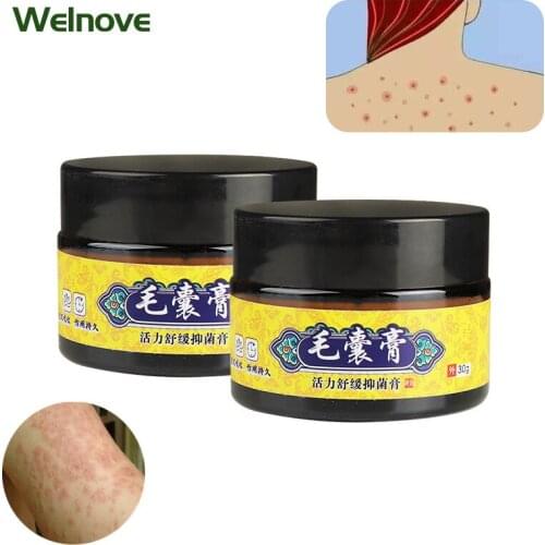Pruritus Eczema Dermatitis Prevention Cream Antibacterial Cream Anti Fungi Ointment Skin Care Chinese Herb Medical Plaster 30g
