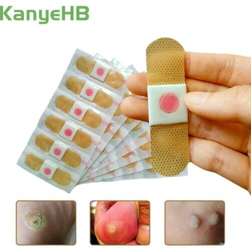 30pcs New Foot Corn Removal Plaster Warts Thorn Remove Corn Foot Patches Anti-germ Pad Patch Plantar Killer Feet Foot Treatment