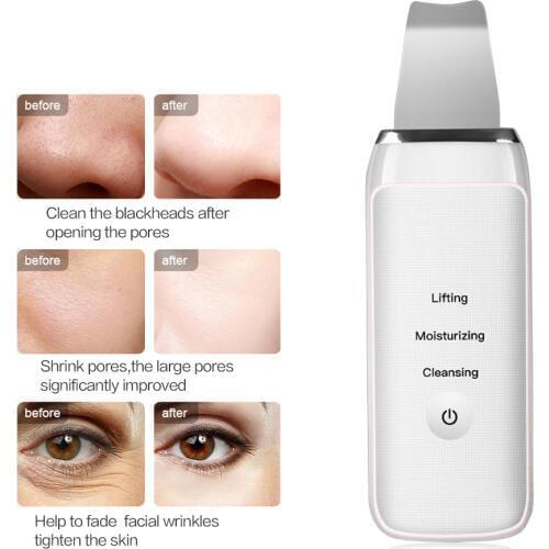 Ultrasonic Deep Face Cleaning Machine Ultrasonic Face Skin Scrubber Facial Cleaner Vibration Blackhead Removal Exfoliating Pore