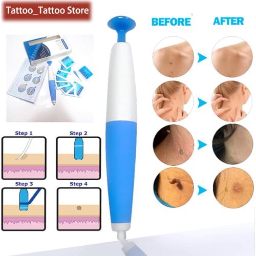 1kit Tag Remover Kits Face Auto Band Skin Care Beauty Tools Wart Remove Acne Pimple Blemish Treatments With 10pcs Rubber bands