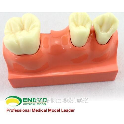 ENOVO Dental anatomical model of dental anatomy model
