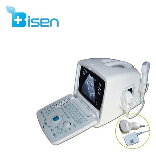Cheap powerful function ultrasound scanner with convex array probe pretty and portable appearance