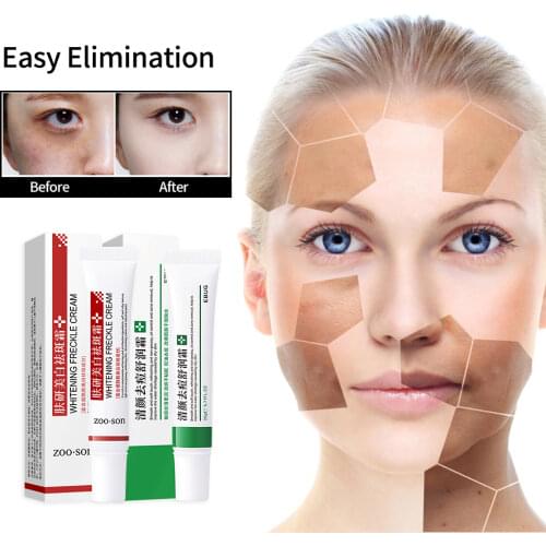 Effective Whitening Freckle Cream Remove Dark Spots Anti Freckle Cream Fade Pigmentation Melasma Brighten Creams Skin Care TSLM1