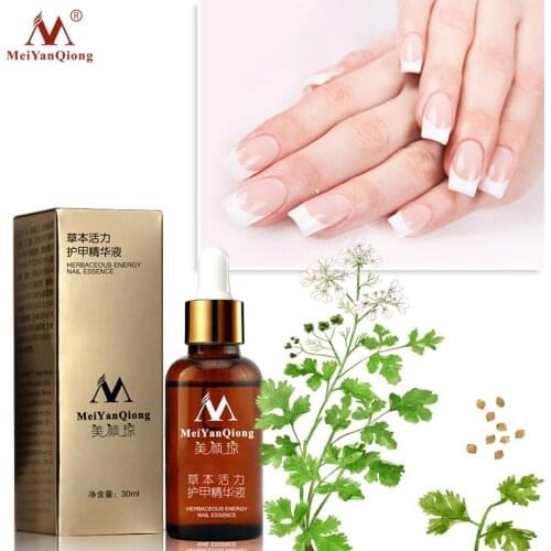 MeiYanQiong Fungal Nail Treatment Feet Care Essence Nail Foot Whitening Toe Nail Fungus Removal Gel Anti Infection Paronychia