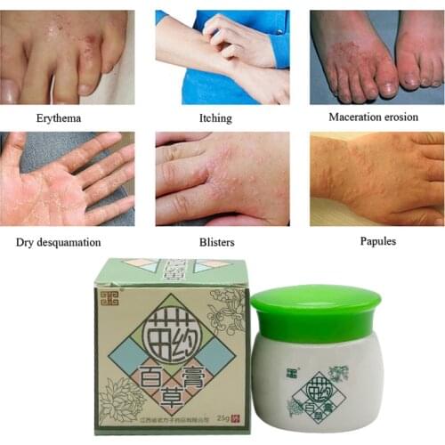 Chinese Medicine Antipruritic Cream Four Seasons Effective Treatment Psoriasis Dermatitis Allergy Skin Itching Baicao Ointment