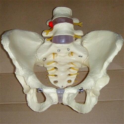 1: 1 human pelvis model 2 lumbar vertebrae pathological changes Medical teaching aids for human skeleton model teaching