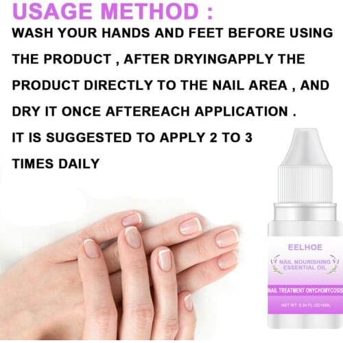 Nourishing Onychomycosis Cure Nail Essence Oil Portable Fungus Treatment Home Travel Repair Infection Moisturizing Hands Feet