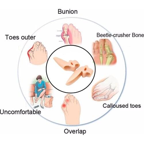 1/2/3/4Pair Orthopedics Hallux Valgus Bunions Corrector Gel Toe Care Protection Foot Cover Separator Pedicure Straightener Tools