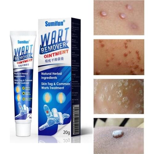Wart Skin Tag Removal Body Warts Treatment Cream Neck Foot Care Cream Skin Tag Remover Foot Corn Removal Plantar Warts Ointment