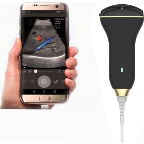 USB And Type-C Andriod Windows Echo Handheld Color Doppler Machine Convex Probe With C E