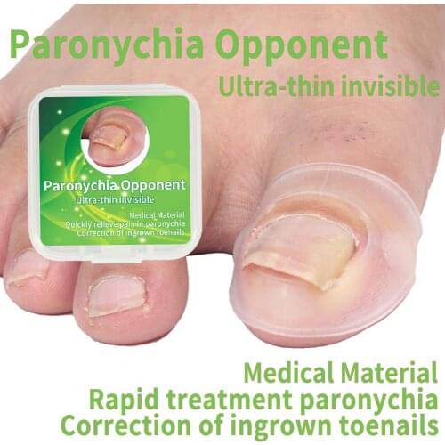 1 Pair Ingrown Toenail Correction Tool Ultra Thin Release Pressure Invisible Orthognathic Silicone Nail Correction Pad