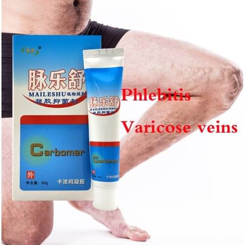 Chinese Varicose Vein Removal Natural Treatment for Relief Phlebitis Angiitis Home Remedies for Spider Varicose Veins Cream