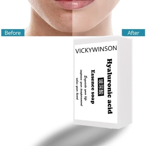 Hyaluronic acid essence handmade Soap 50g Natural essence soap anti-acne oil control bright white cleaning hand