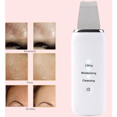 Ultrasonic Skin Scrubber Deep Face Cleaning Machine Peeling Shovel Facial Pore Cleaner Face Skin Scrubber Skin Lifting Beauty