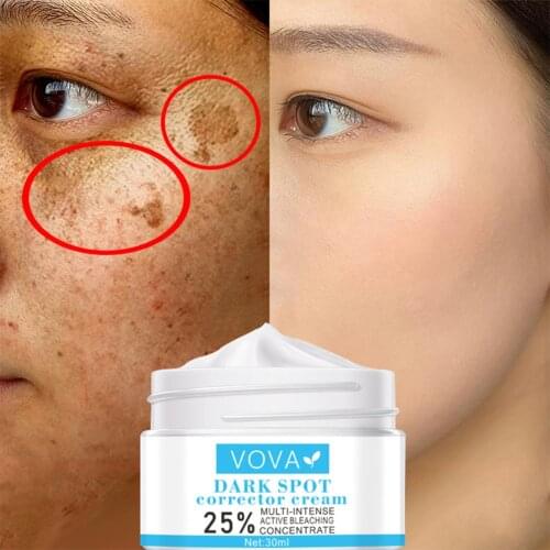 VOVA Dark Spot Removal Whitening Skin Cream Remove Melasma Acne Spot Pigment Melanin Dark Spot Pigmentation Moisturizing Gel 30g