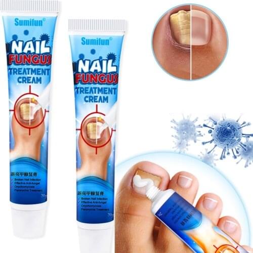 1Pcs Nail Fungus Removal Cream Onychomycosis Fungal Nail Treatment Paronychia Anti Infection Feet Toe Fungal Nail Care Ointment