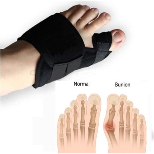 2pcs Toe Straightener Corrector Brace Pad For Hallux Valgus Pain Relief Bunion Splint Guard Toe Separator Supports Foot Care