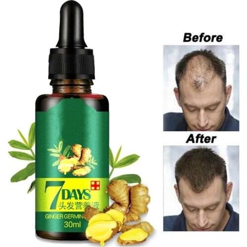 7 Days Germinal Hair Growth Serum Essence Oil Hair Loss Treatment Growth Hair for Men Women for Damaged Hair Repair Natural Hai