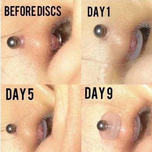 10pcs/set Gaskets Silicone Piercing Healing Discs Flexible Anti Hyperplasia Saucer Ear Nose Soft Gasket Tragus Anti Invagination