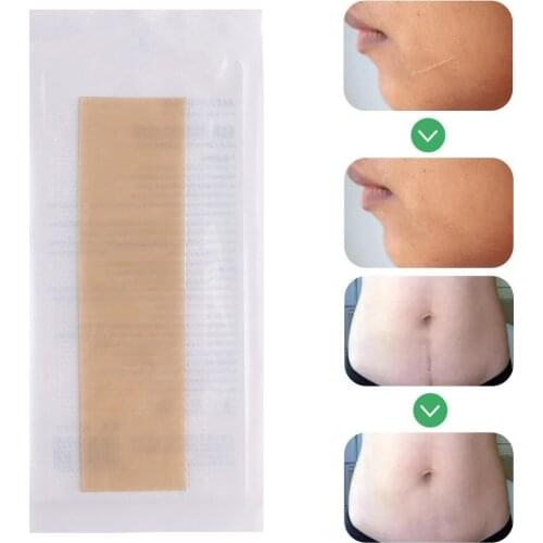 Scar Treatment Silicone Removal Patch Tape Sheets Efficient Surgery Gel Scar Therapy Acne Trauma Burn Scar Cover Skin Repair