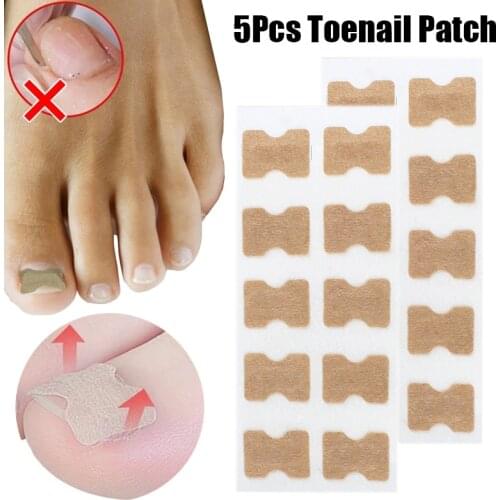 5pcs/set Toenail Corrector Sticker Paronychia Treatment Recover Elastic Patch Pedicure Non Glue Toe Nail Ingrown Care Tools
