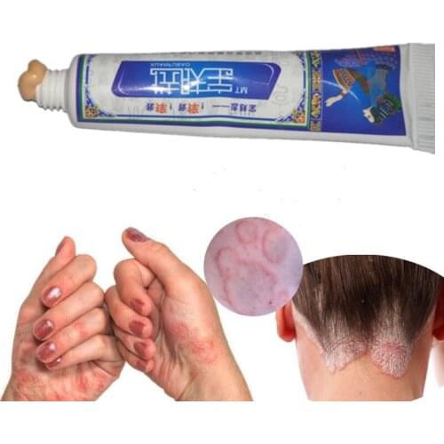 Body Cream Skin Psoriasis Cream Dermatitis Itching Repair Eczematoid Ointment Treatment Psoriasis Eczema Itching Natural Herbal