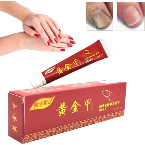 Nail Fungus Treatment / Onychomycosis Paronychia / Anti Fungal Nail Infection Chinese Herbal Toe Nail Treatment