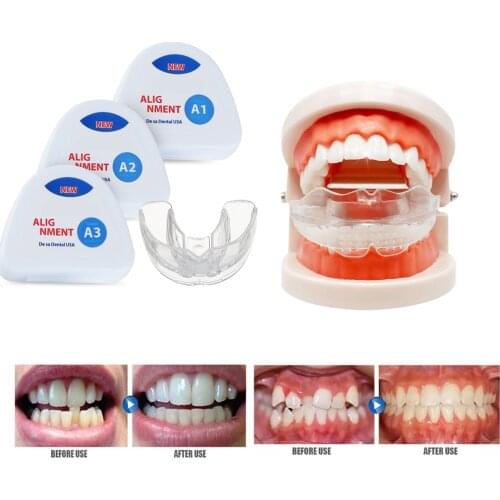 Dental Orthodontic Appliance Tooth Orthodontic Braces Trainer Dental Braces Teeth Trainer Alignment Braces Mouthpiece 3 Phases
