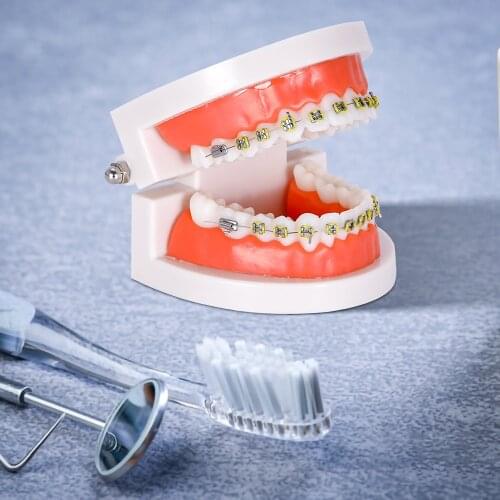 Orthodontic Teeth Model Bracket Model 1: 1 Orthodontic Model Educational Model Dental Educational Equipment