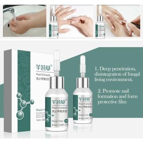 1pc 20ml Natural Plant Extracts Anti Fungal Toe Finger Fungus Antibacterial Nail Liquid Antibacterial Solution TSLM1
